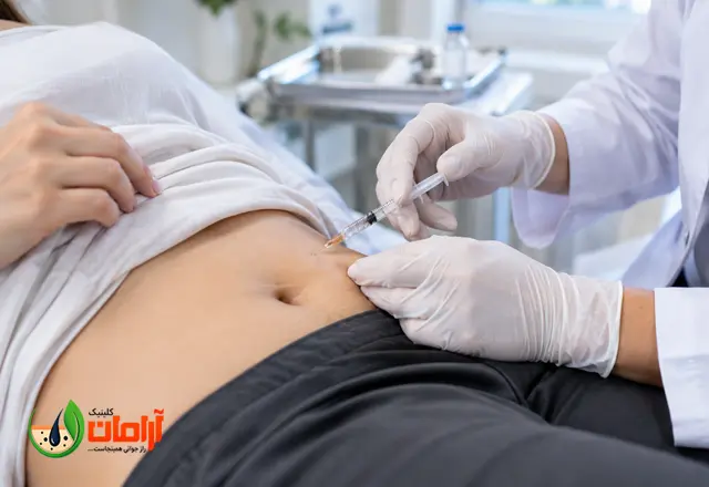 بوتاکس معده چند کیلو کم میکند؟