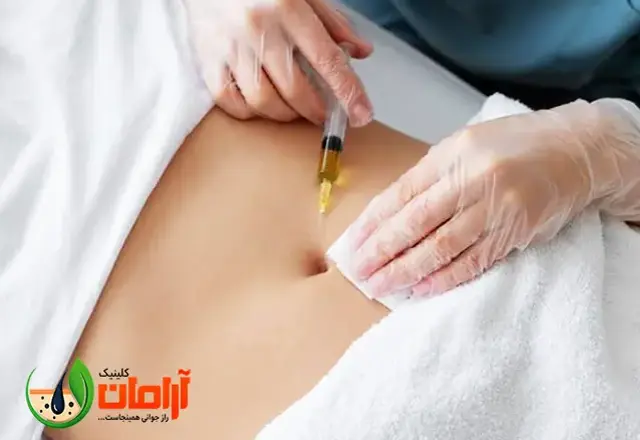 بوتاکس معده چیست و برای لاغری چقدر موثر است؟