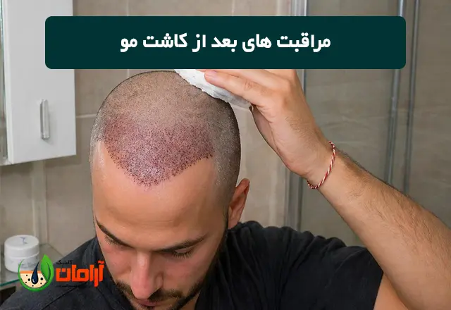 مراقبت های بعد از کاشت مو